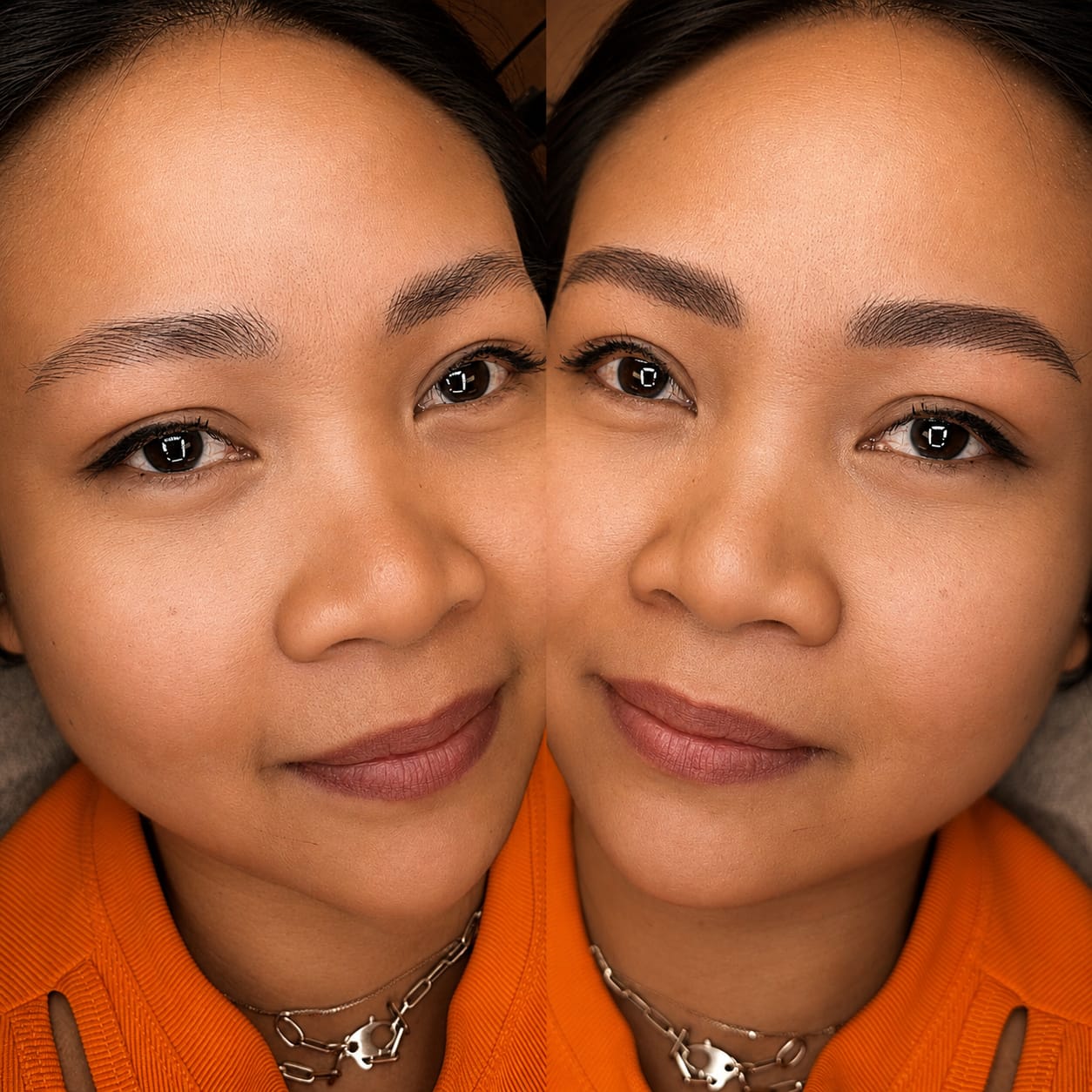 Nano Hair Stroke (Women) result at Sonthuy Beauty