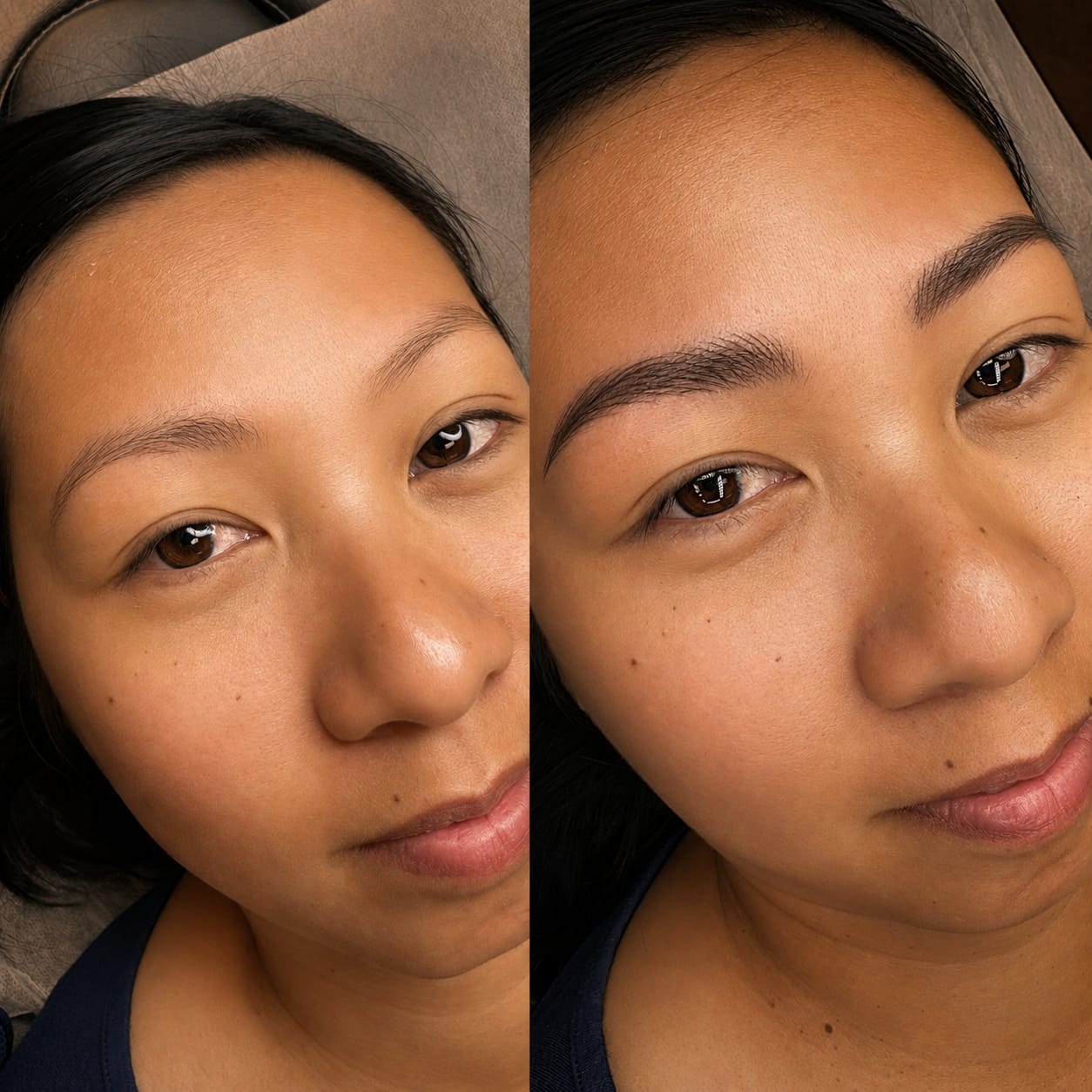 Nano Hair Stroke (Women) result at Sonthuy Beauty