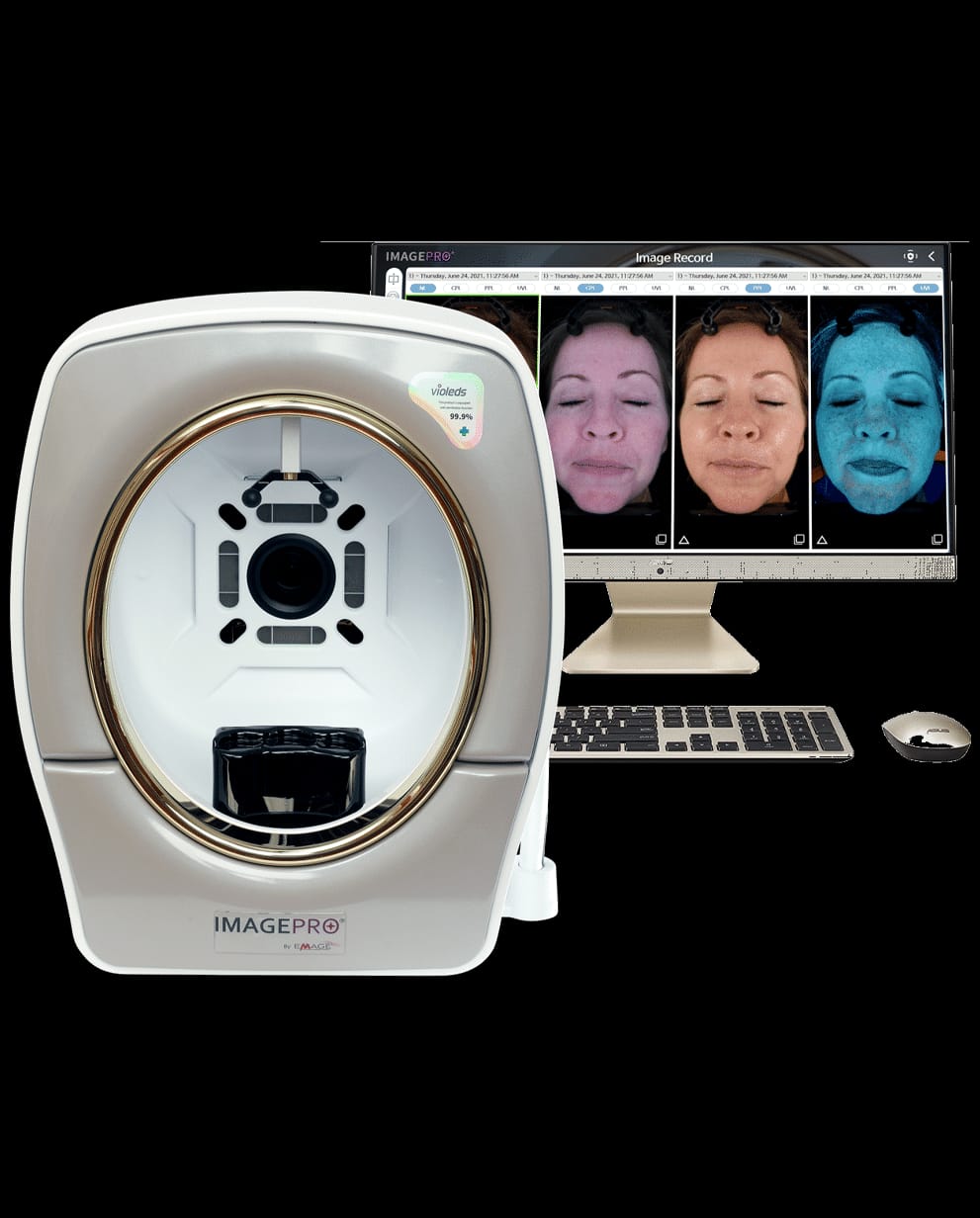 The ImagePro system displaying a multi-spectral facial scan on screen