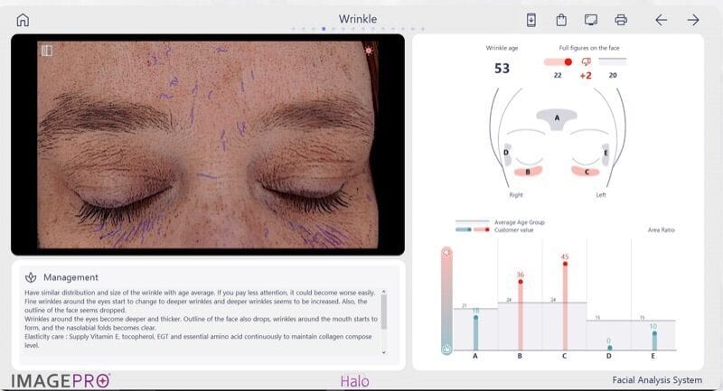 ImagePro facial analysis screen mapping wrinkle distribution and skin metrics